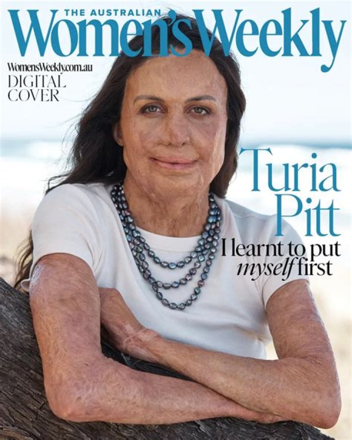 
Turia Pitt Height, Weight, Net Worth, Age, Birthday, Wikipedia, Who, Nationality, Biography 